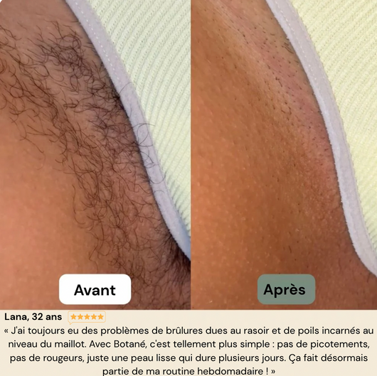 Crème Épilatoire à l'Aloe Vera - Peau lisse. Sans rasoir. Sans douleur.